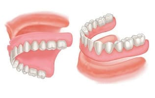 Set of full dentures